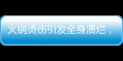 火鍋燙傷引發(fā)全身潰爛，三歲男童遭遇驚魂事件