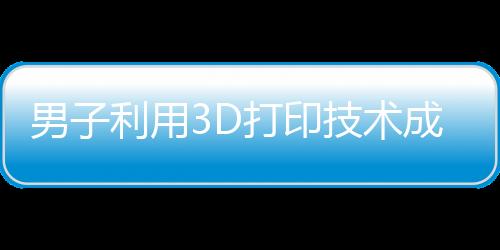 男子利用3D打印技術(shù)成功為舅舅接上斷指