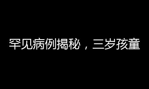 罕見病例揭秘，三歲孩童全身脫皮引發(fā)關注熱潮