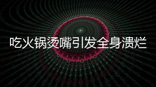 吃火鍋燙嘴引發(fā)全身潰爛，警醒！火鍋美食背后的健康隱患