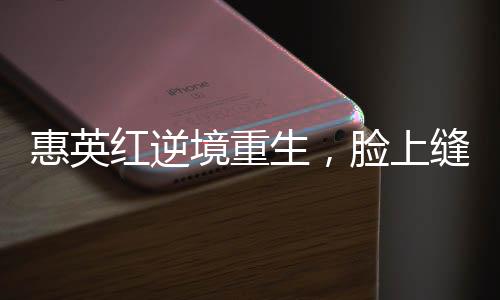 惠英紅逆境重生，臉上縫了89針的堅(jiān)韌故事