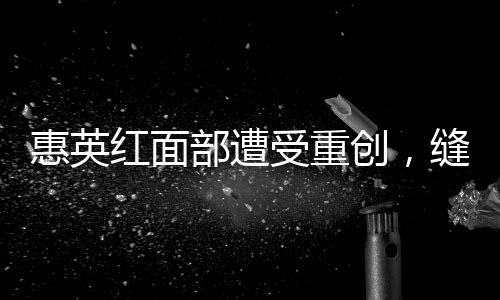 惠英紅面部遭受重創(chuàng)，縫針達89次——演藝界的堅韌之星