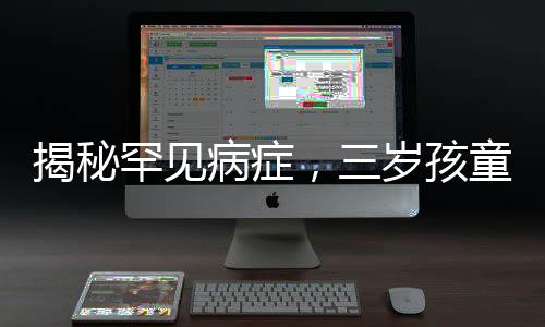 揭秘罕見(jiàn)病癥，三歲孩童全身離奇起皮脫衣事件引發(fā)關(guān)注