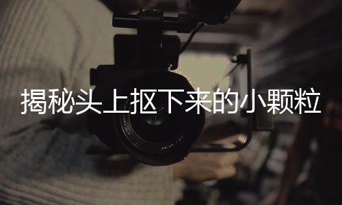 揭秘頭上摳下來的小顆粒，它們究竟是何物？