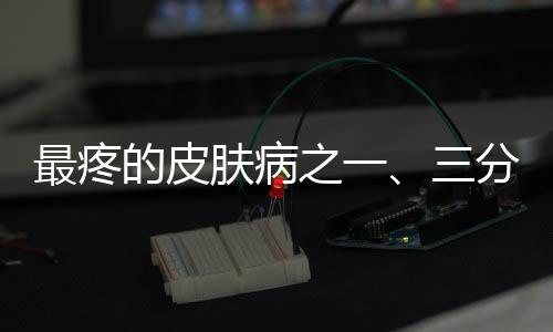 最疼的皮膚病之一、三分之一人群面臨挑戰(zhàn)