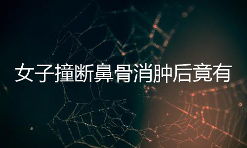 女子撞斷鼻骨消腫后竟有高鼻梁，奇妙經(jīng)歷揭示醫(yī)學(xué)魅力