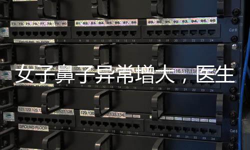 女子鼻子異常增大，醫(yī)生迅速識(shí)別背后隱藏的隱患