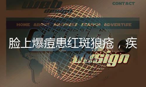 臉上爆痘患紅斑狼瘡，疾病解析與應(yīng)對(duì)之道