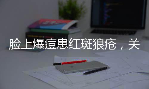 臉上爆痘患紅斑狼瘡，關注病癥與應對之道