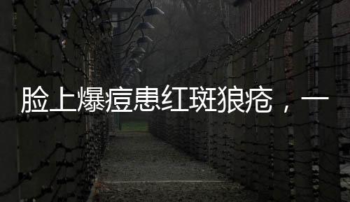 臉上爆痘患紅斑狼瘡，一位患者的深度解析與自我反思