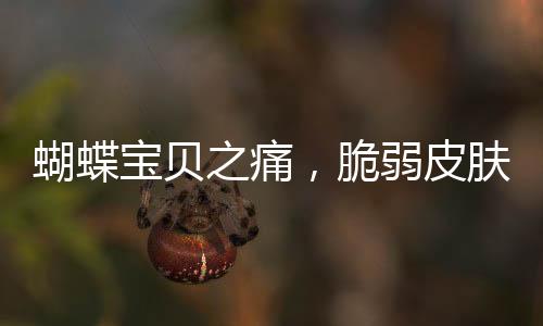 蝴蝶寶貝之痛，脆弱皮膚的挑戰(zhàn)與希望