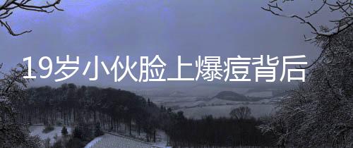 19歲小伙臉上爆痘背后隱藏紅斑狼瘡真相揭秘